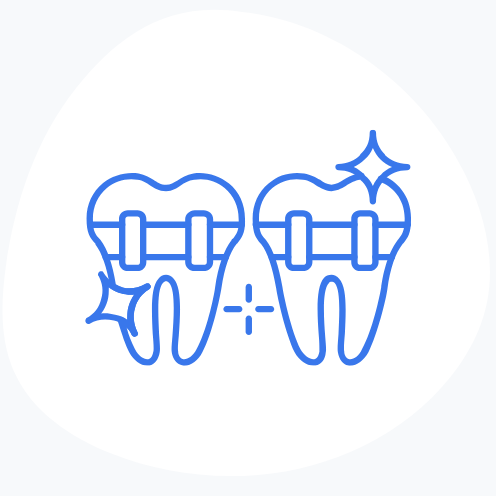 Dr_Moritz-Fray_Aligner-Therapie